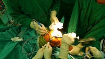 国产膝关节置换演示视频,革新医疗，守护关节健康